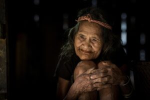 開き毛穴対策におすすめの化粧品トライアルは？